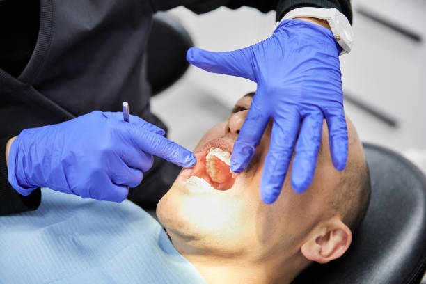 Best Emergency Denture Repair in Warm Mineral Springs, FL